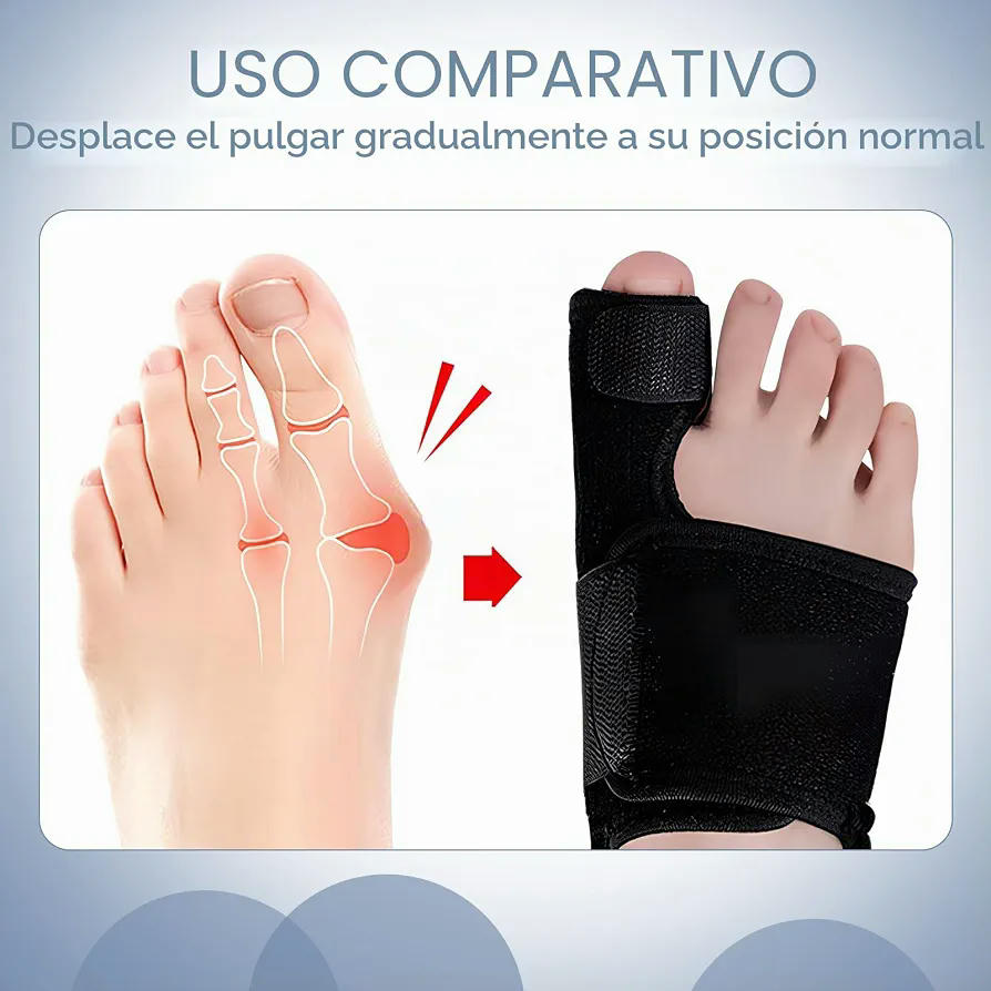 Soportes Ortodónticos para Juanetes, Unisex, Ajuste Regulable, Invisibles y Cómodos, Incluyen Puntales de Aluminio (Negro)